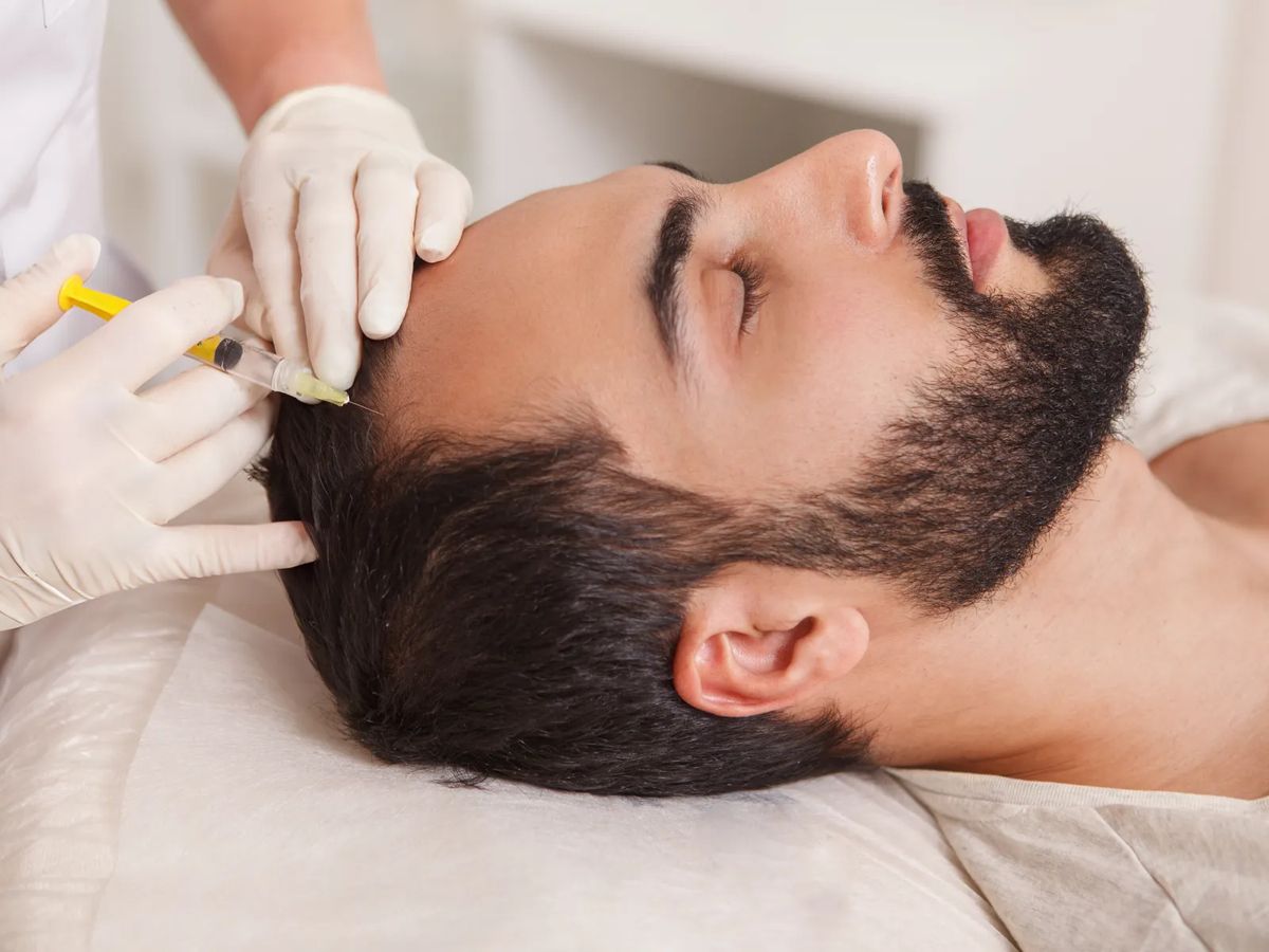 Mesotherapy Before After Results in Nagpur